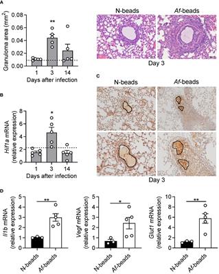 Hypoxia inducible-factor 1 alpha regulates neutrophil recruitment during fungal-elicited granulomatous inflammation